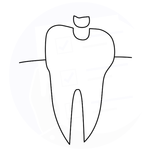 Intarsio dentale (inlay)